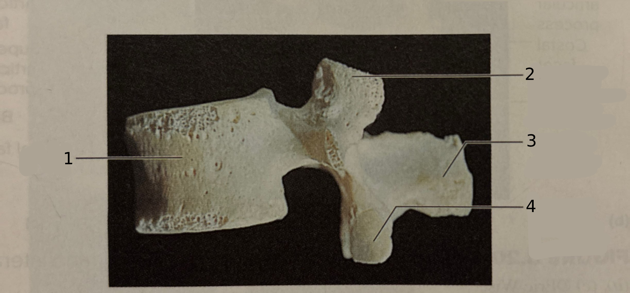 <p>What type of vertebra is this?</p>