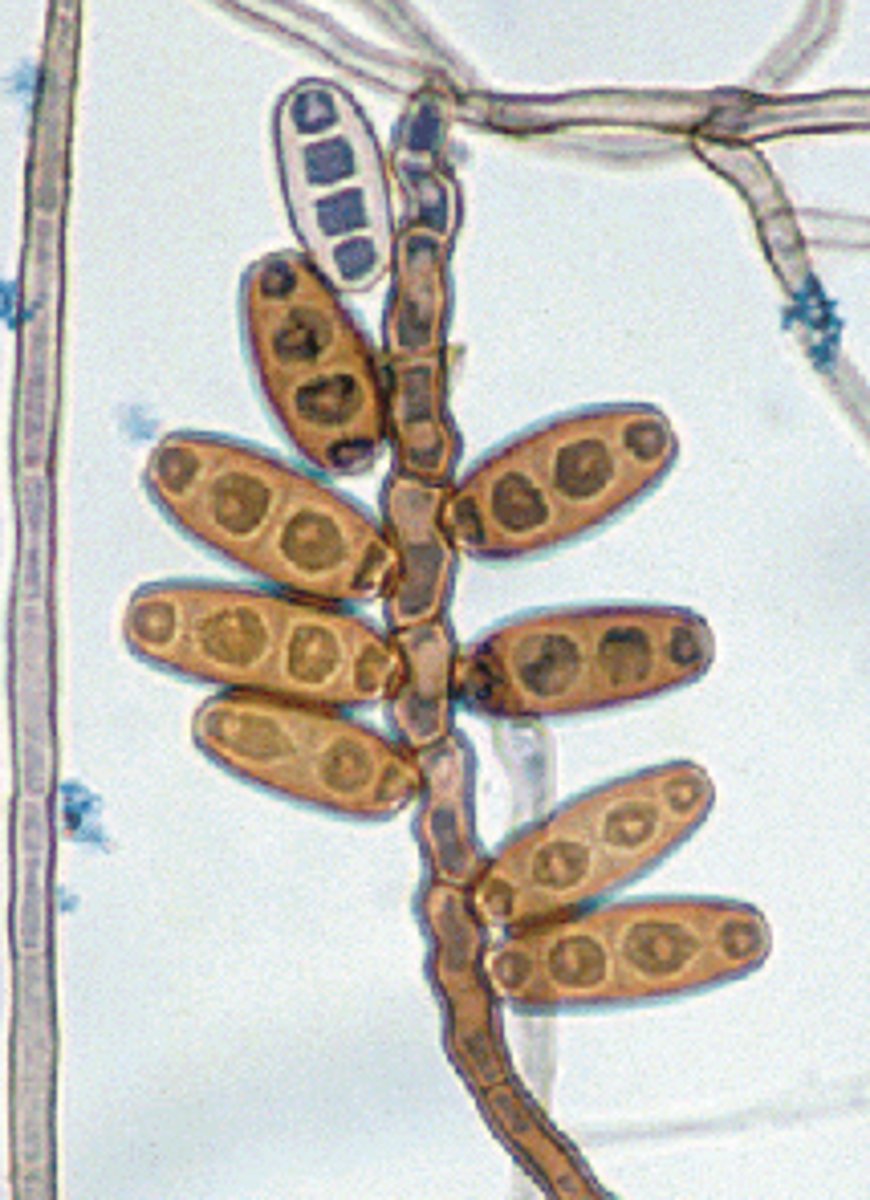<p>2-3 days</p><p>Velety, wooly, gary-brown</p><p>Reverse: black</p><p>Microscopic: septate, dark hyphae</p><p>--cylindrical-shaped poroconidia with 4-5 cells inside</p><p>Conditions: keratomycosis and fungal sinusitis</p>