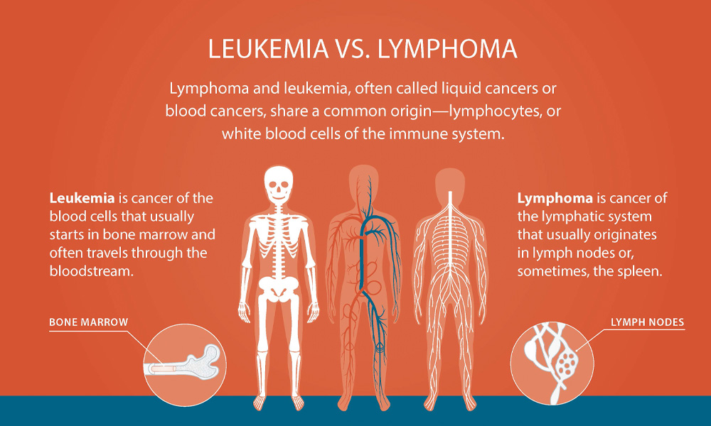 <ol><li><p>Leukemias = myeloid</p></li><li><p>Lymphomas = lymphoid</p></li></ol><p></p>