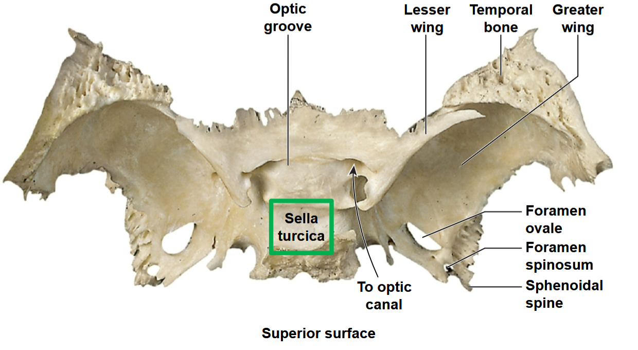 <p>What bone is this?</p>
