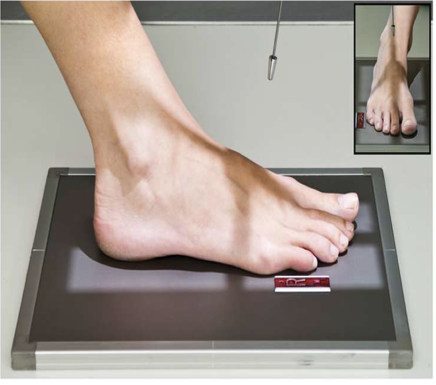 <p>Patient Position   </p><p class="p1"><span style="line-height: normal;"><span> </span></span>Sitting or lying on table</p><p class="p1"><span style="line-height: normal;"><span> </span></span>Planter surface of foot on the table</p><p class="p1"><span style="line-height: normal;"><span> </span></span>May be performed with patient standing on IR*</p><p class="p1"><span style="line-height: normal;"><span> </span></span>NOTE: CR angle may need to be increased when patient is standing</p><p class="p1"></p><p class="p1">Part Position</p><p class="p1"><span style="line-height: normal;"><span> </span></span>Plantar surface flat against IR</p><p class="p1"><span style="line-height: normal;"><span> </span></span>No rotation</p><p class="p1"></p><p class="p1">CR</p><p class="p1"><span style="line-height: normal;"><span> </span></span>Angle approx. 10<span style="line-height: normal;"><span>◦ </span></span>toward heel; centered to base of 3<span style="line-height: normal;"><span>rd </span></span>metatarsal</p><p class="p1"><span style="line-height: normal;"><span> </span></span>Patients with a high longitudinal arch require a greater angle</p><p class="p1"><span style="line-height: normal;"><span>o </span></span>15-degrees</p><p class="p1"><span style="line-height: normal;"><span> </span></span>A low longitudinal arch requires less angle</p><p class="p1"><span style="line-height: normal;"><span>o </span></span>5-10 degrees</p><p class="p1"></p><p class="p1">Collimation</p><ul><li><p class="p1">Include entire foot</p></li></ul><p></p>