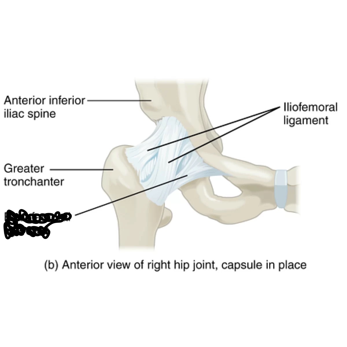 <p>what ligament is crossed out in the picture?</p>