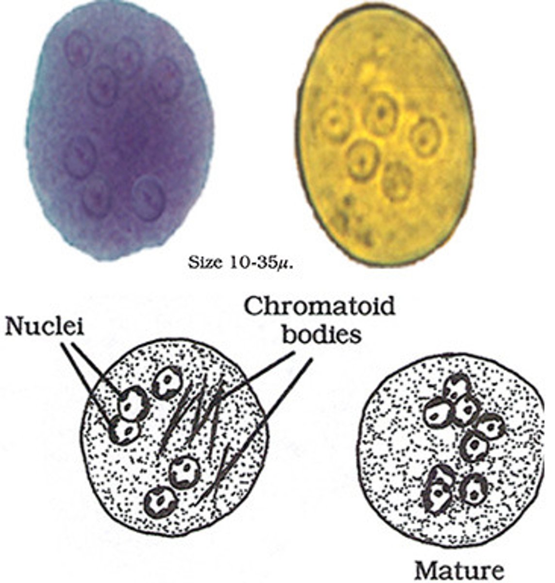 <p>*similar to histolytica, BUT can have up to 8 nuclei<br>*chromatoid bars if present, have splintered/pointed ends</p>