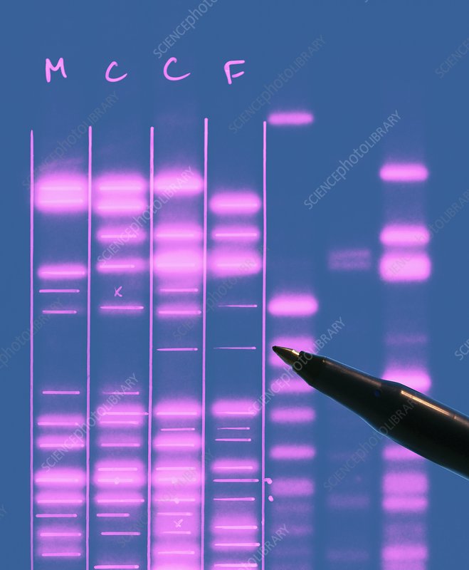 * DNA extracted and cut into fragments of varying sizes by restriction endonucleases
* DNA samples loaded into well at one end of gel
* voltage applied across the gel → phosphate groups of DNA backbone negatively charged so fragments attracted to anode
* if fragments of known length (DNA ladder) are separated on same gel at same time, length of fragments under test can be estimated
* electrophoresis trough covered with nylon membrane → picks up DNA fragments (Southern blotting)
* radioactive/luminescent DNA probes (contain sequences complementary to STRs) attach by base pairing to specific parts of fragment 
  * unbound probes washed off
* film sensitive to x-rays/wavelengths given off by luminescent probe placed over Southern blot overnight
* film exposed and autoradiograph reveals banding pattern 
  * dark bands show position of probe and therefore repeated sequences
  * this pattern is the genetic profile
