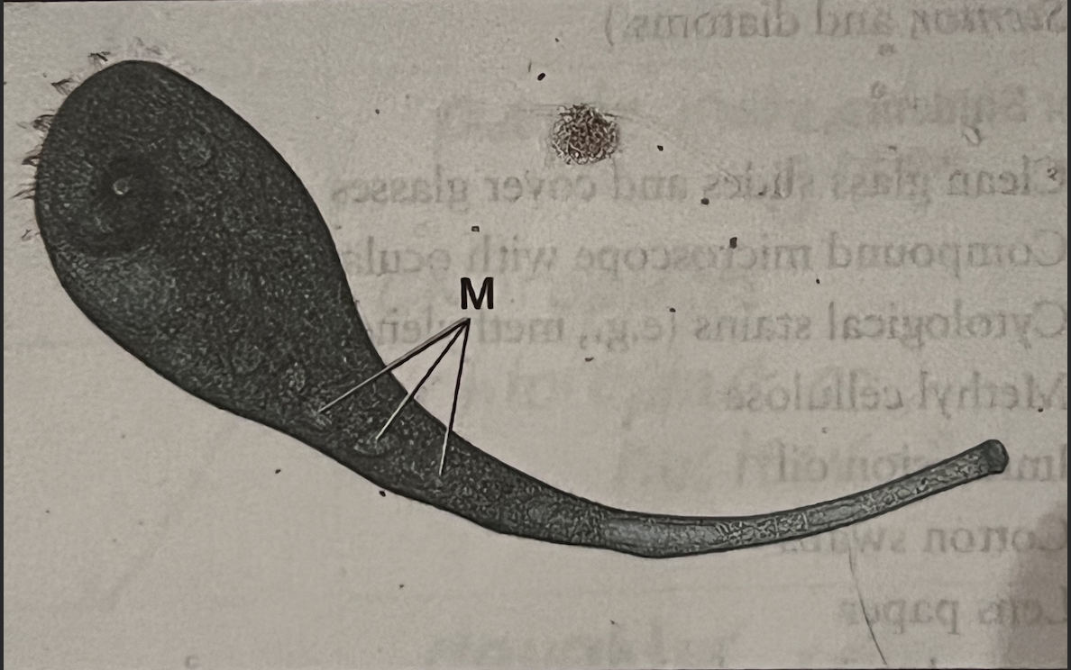 Stentor 