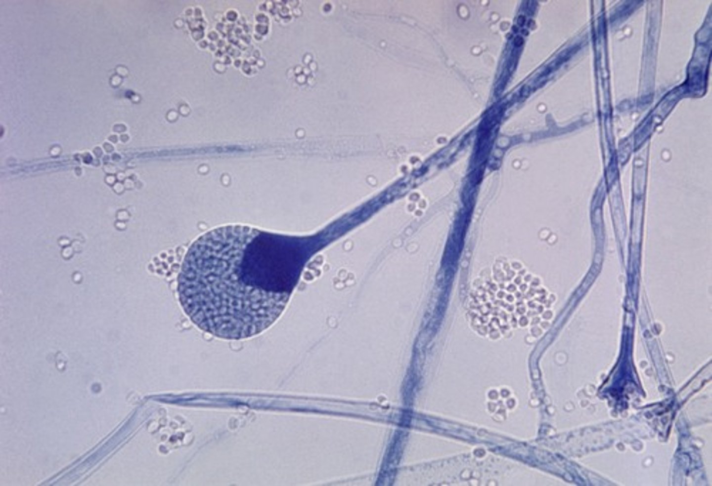 <p>spore-bearing structure found in various fungi</p>