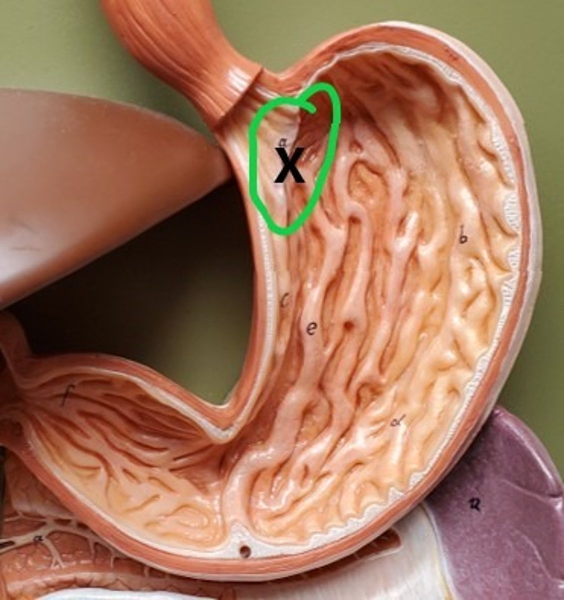 <p>ID the Region of the Stomach</p>