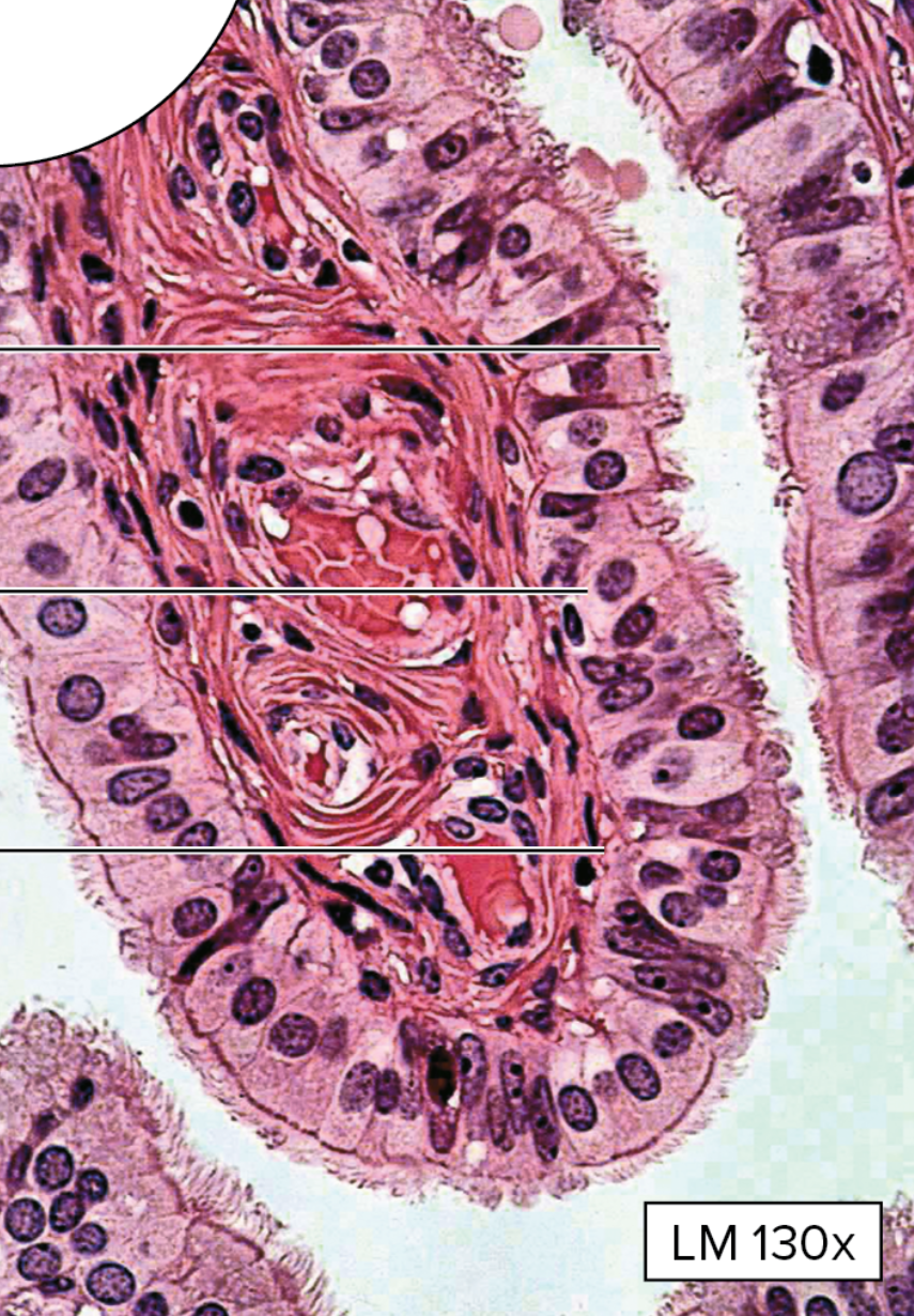 <p>What type of epithelial tissue is this?</p>