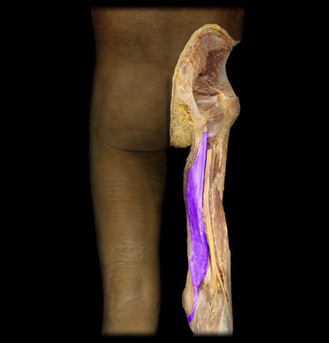 <p>extends thigh and flexes leg</p>