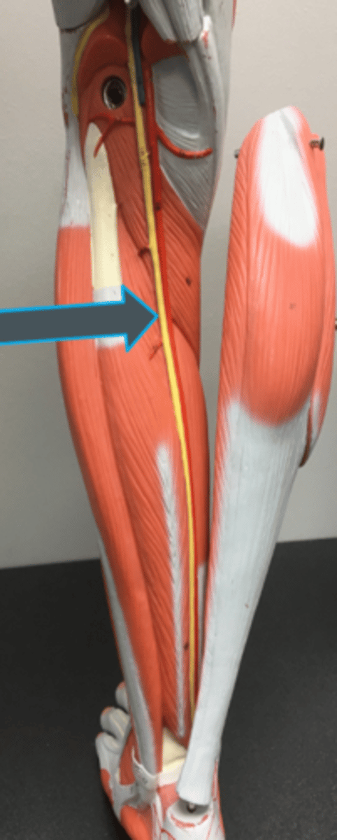 <p>innervates:<br>- biceps femoris<br>- semitendinosis<br>- semimembranosis<br>- gastrocnemius<br>- soleus<br>- tibialis posterior</p>