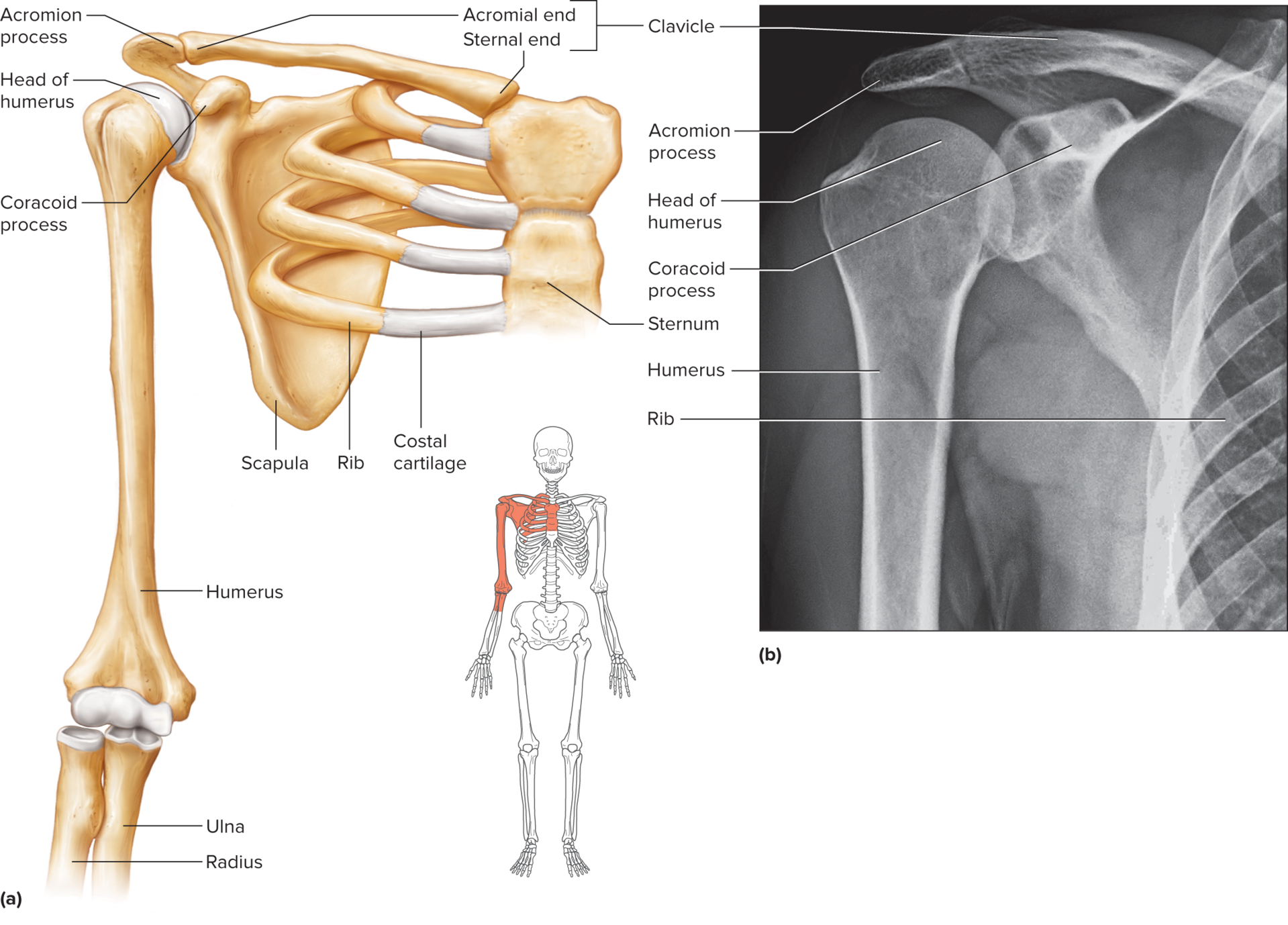 <p>aka shoulder girdle</p><p>composed of four parts: two clavicles and two scapulae</p><p>incomplete ring; open in the back between the scapulae and sternum separates its bones in front</p>