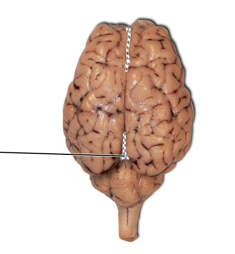<p>What is the line down the midsagittal plane of the brain called?</p>
