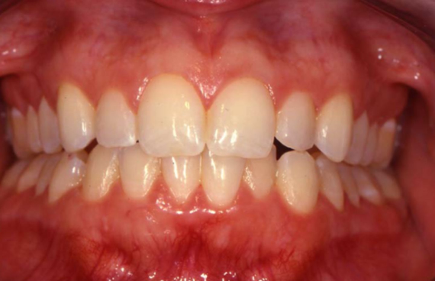 <p>What is the tissue biotype?</p>