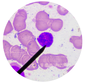 <p>what kind of white blood cells is this?</p>