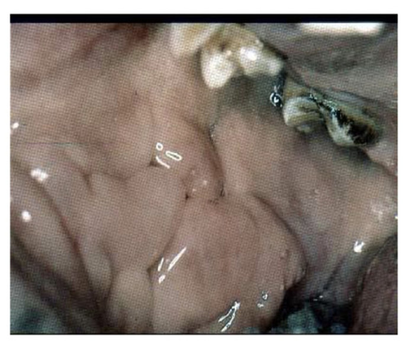 <p>What is this and what is it caused by?</p>