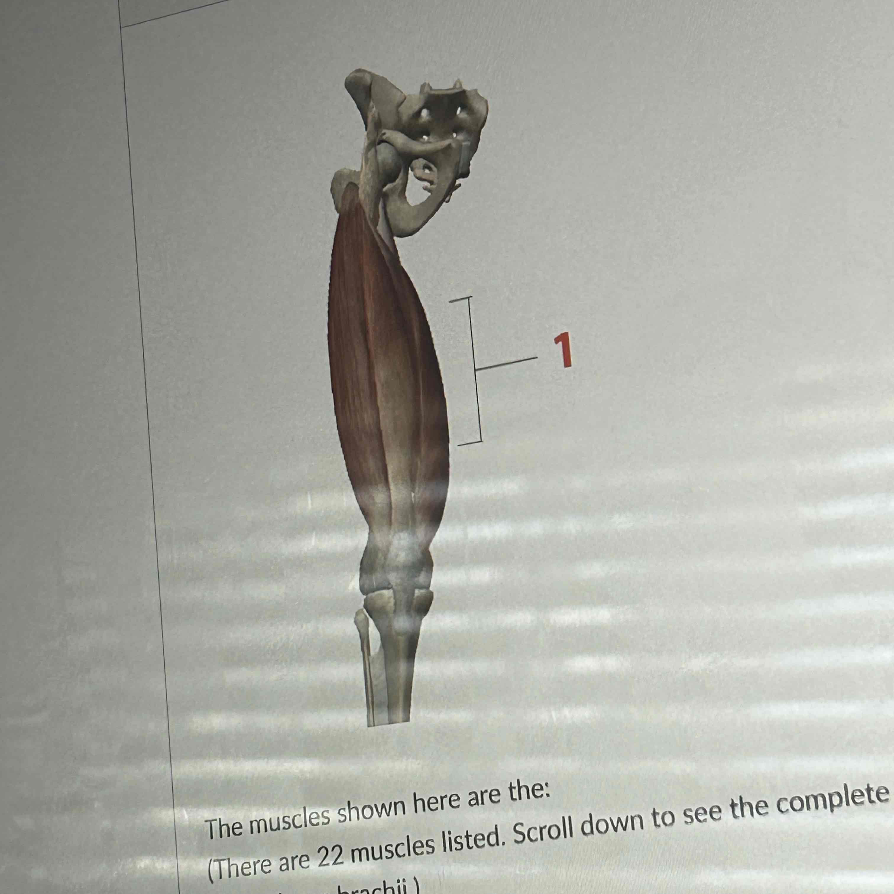 <p>The muscle shown here are the </p>