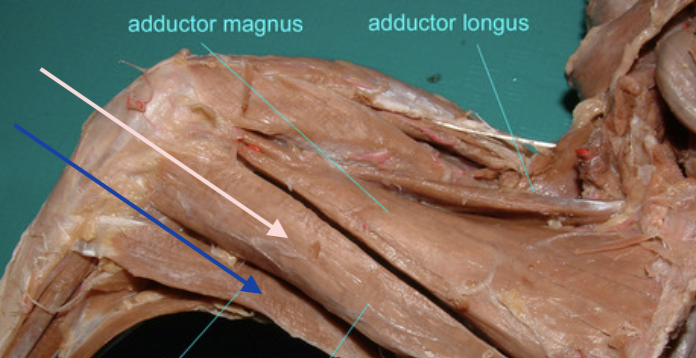 <p>blue arrow, more lateral</p>