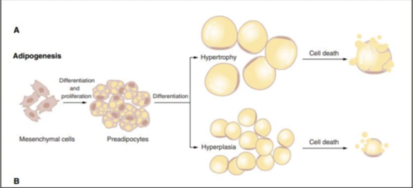 <p>Hypertrophic obesity: enlarged adipocytes</p><p>Hyperplastic obesity: increased number of adipocytes</p>