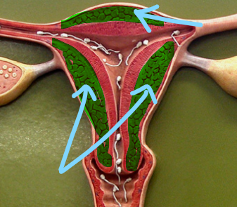 <p>Myometrium</p>
