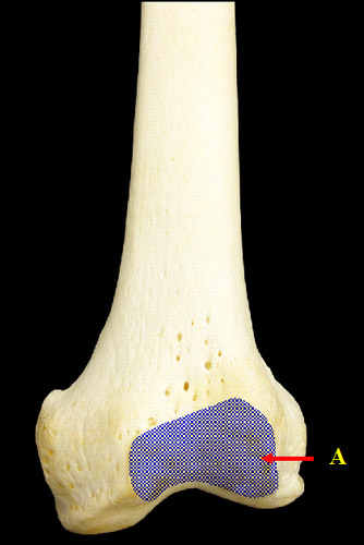 label the features of the anterior surface and posterior surface of the left femur:
___________ _______________