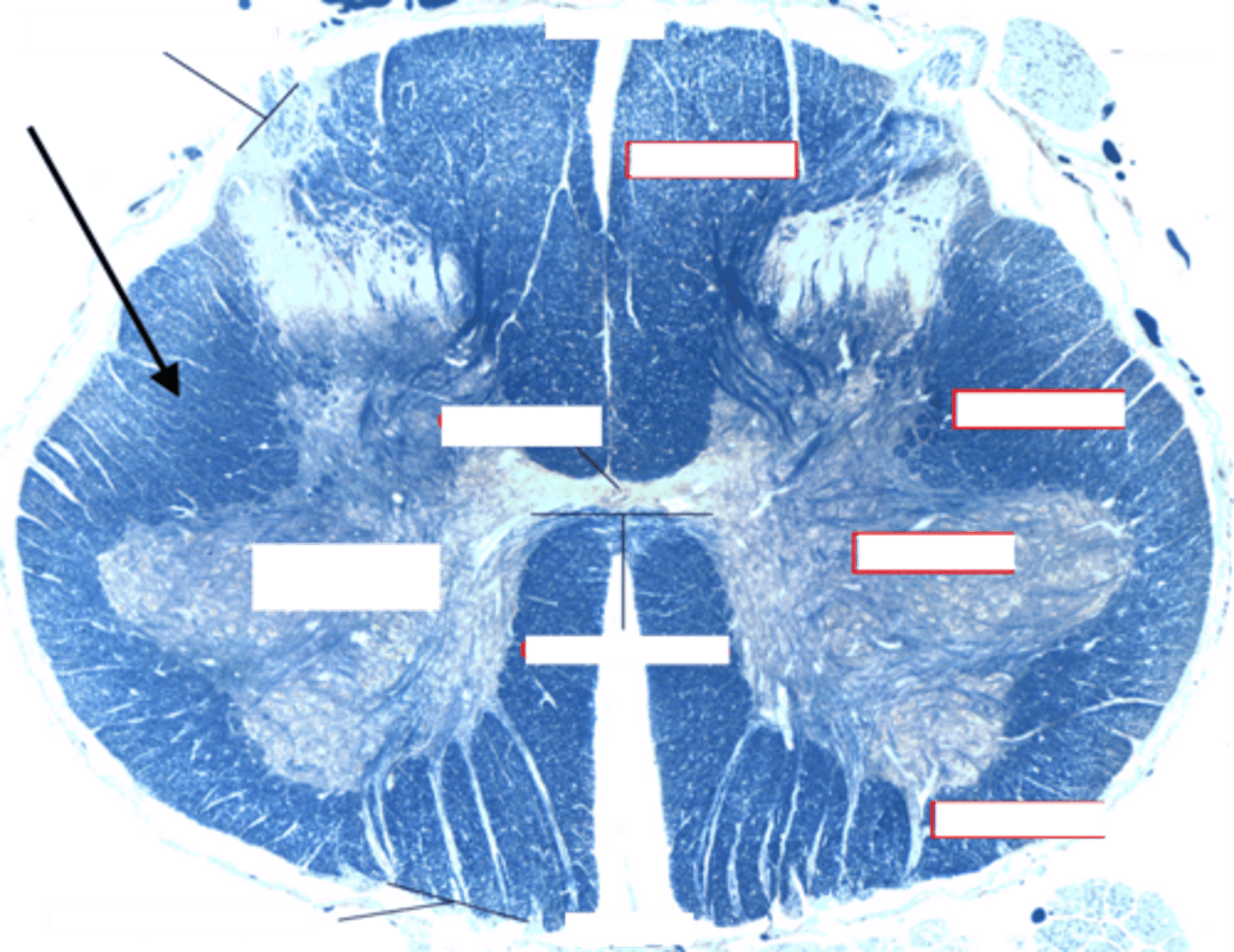 <p>What type of tissue is this? (Black arrow)</p>