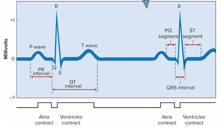 <p>Electrocardiogram (ECG)</p>