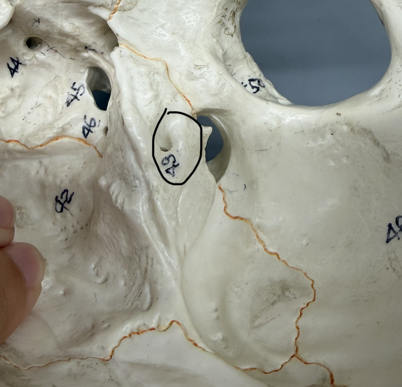 <p>maller hole on medial side of bone; located on petrous portion</p>