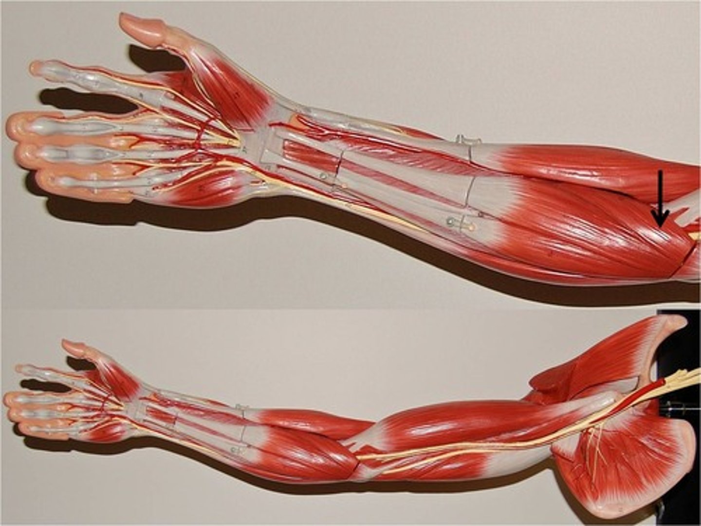 <p>origin: medial epicondyle of humerus</p><p>insertion: radius</p><p>** diagonal from medial humerus to lateral radius</p>