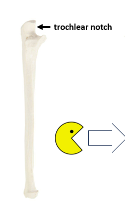 <p>What bone is this?</p>