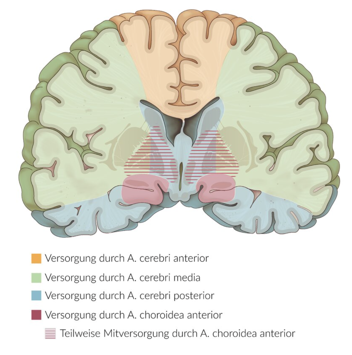 <p>D. Paresis (weakness) of the right leg</p>