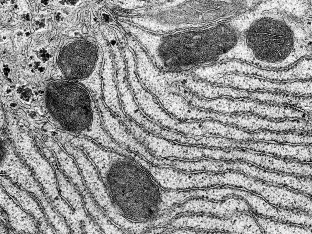 <p>rough endoplasmic reticulum </p>