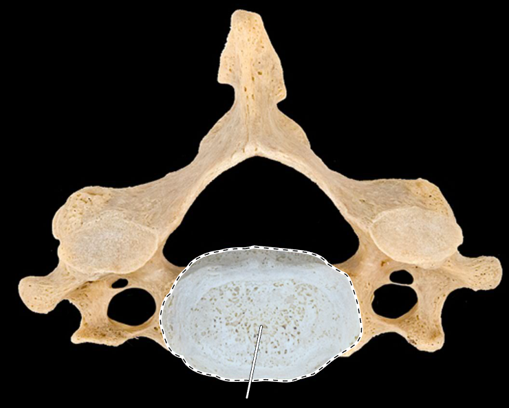 <p>What part of the vertebra is highlighted?</p><p>What type of vertebra is this (which region is this vertebra from)?</p><p>(Superior view).</p>
