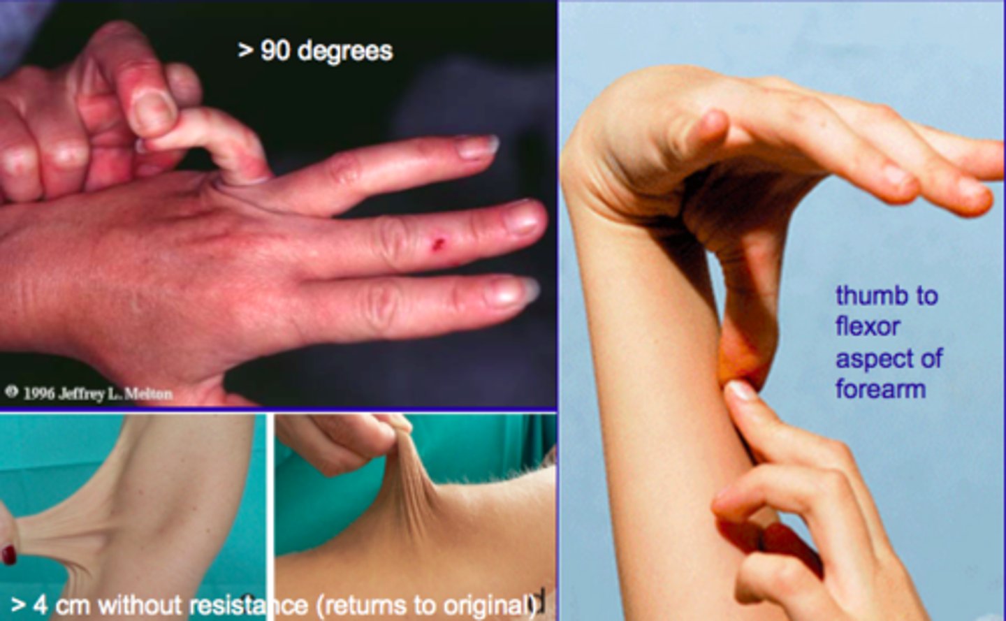 <p>EMP</p><p>joint</p>