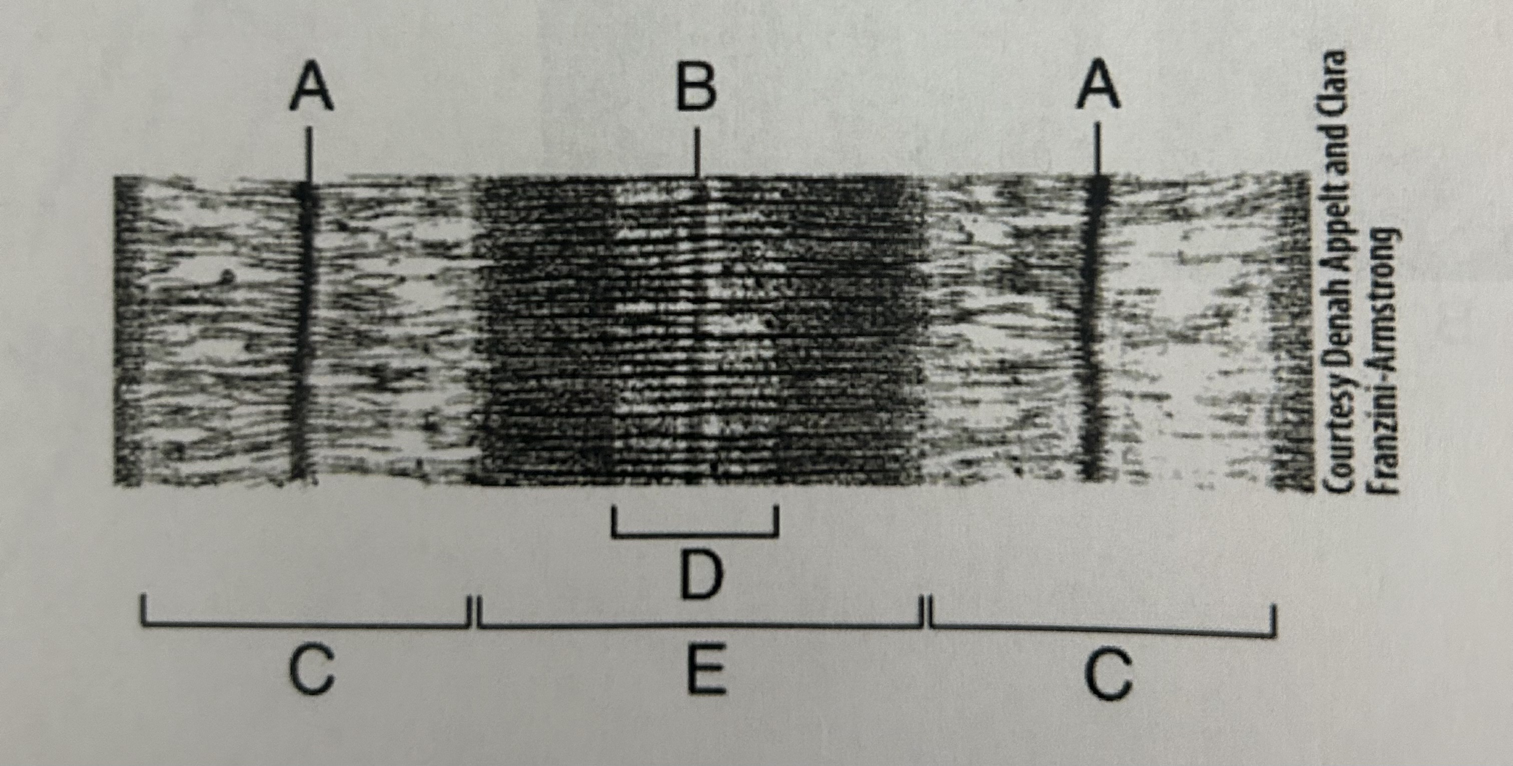 <p>Figure E</p>