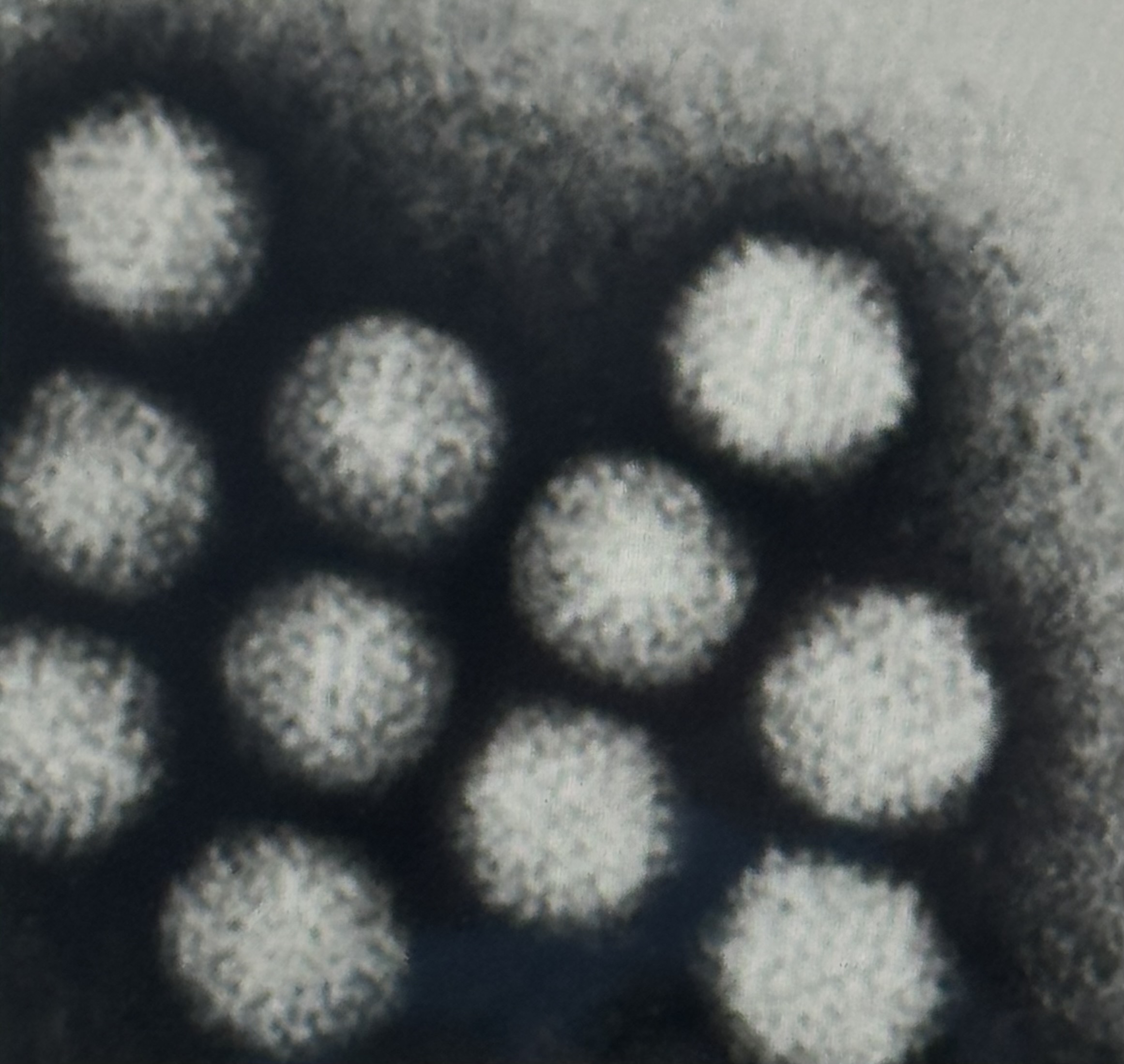 <p>Viren Kurzsteckbriefe Adenoviren</p>