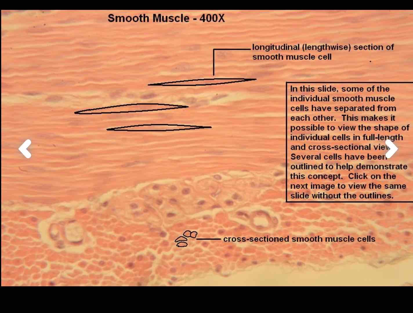 <p>Can you identify this muscle type, provide a function, location, and characteristic.</p>