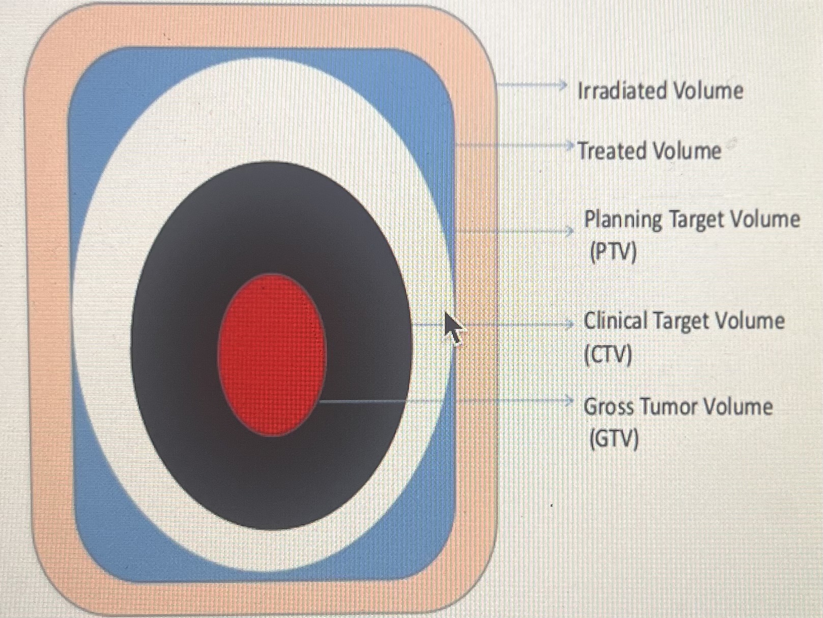 <p><span>What is the radiation therapy prescription?</span></p>