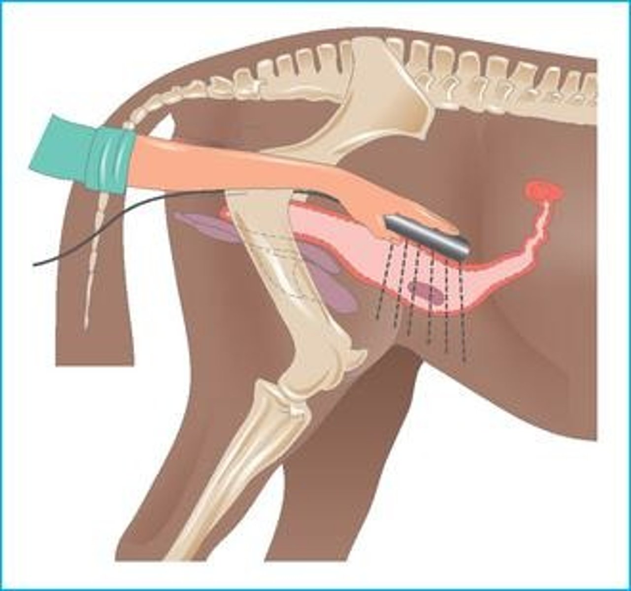 <p>Can be performed from 26 days, with better accuracy at ~40 days, and is &gt;95% accurate.</p>