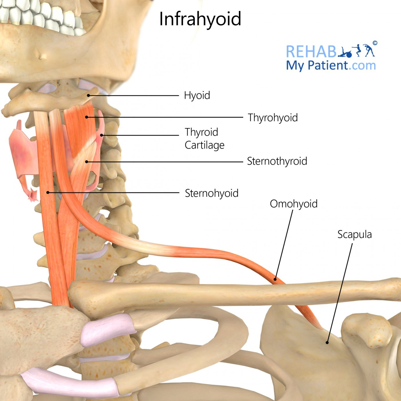 <p>Which of the following does not belong to the infrahyoid muscles?</p><p>A. M. sternothyroideus</p><p>B. M. omohyoideus</p><p><strong><mark data-color="red" style="background-color: red; color: inherit">C. M. sternocleidomastoideus</mark></strong></p><p>D. M. sternohyoideus</p><p>E. M. thyrohyoideus</p><p></p><p><mark data-color="purple" style="background-color: purple; color: inherit">NOT SCALENUS ANTERIOR M. EITHER</mark></p>