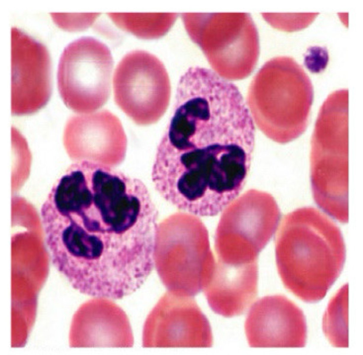<p>Blood smear</p>