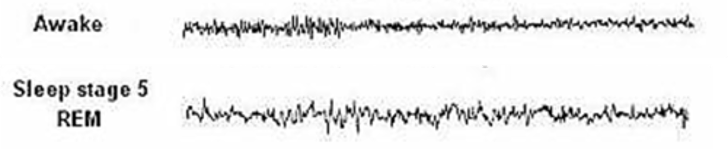 <p>EEG during human REM is similar to ________ _/______ -&gt; ____ voltage mixed ____________</p>