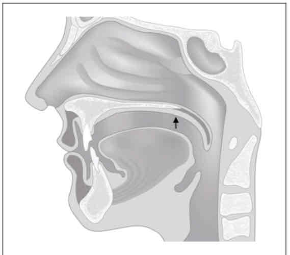 <p>What is the place of articulation? (Tongue body on/near soft palate)</p>