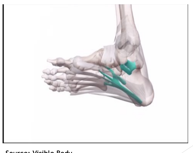 <p>Ligament “Staple” support for arch of foot</p>