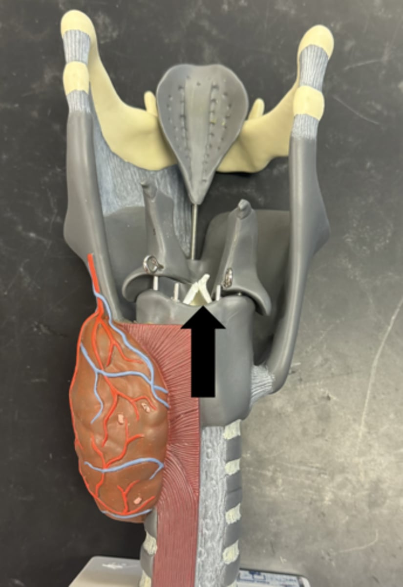 <p>opening found here</p>