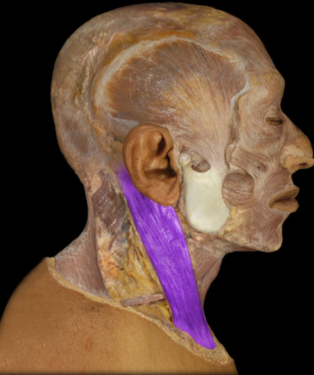 <ul><li><p>Action: Unilateral: rotation of head so face turns to opposite side, Bilateral: flexion of neck, extension of head</p></li><li><p>Origin: Clavicle (medial), Sternum (manubrium)</p></li><li><p>Insertion: Mastoid process of temporal bone, Lateral one-half of superior nuchal line of occipital bone</p></li><li><p>Innervation: Accessory nerve (CN XI)</p></li></ul><p></p>