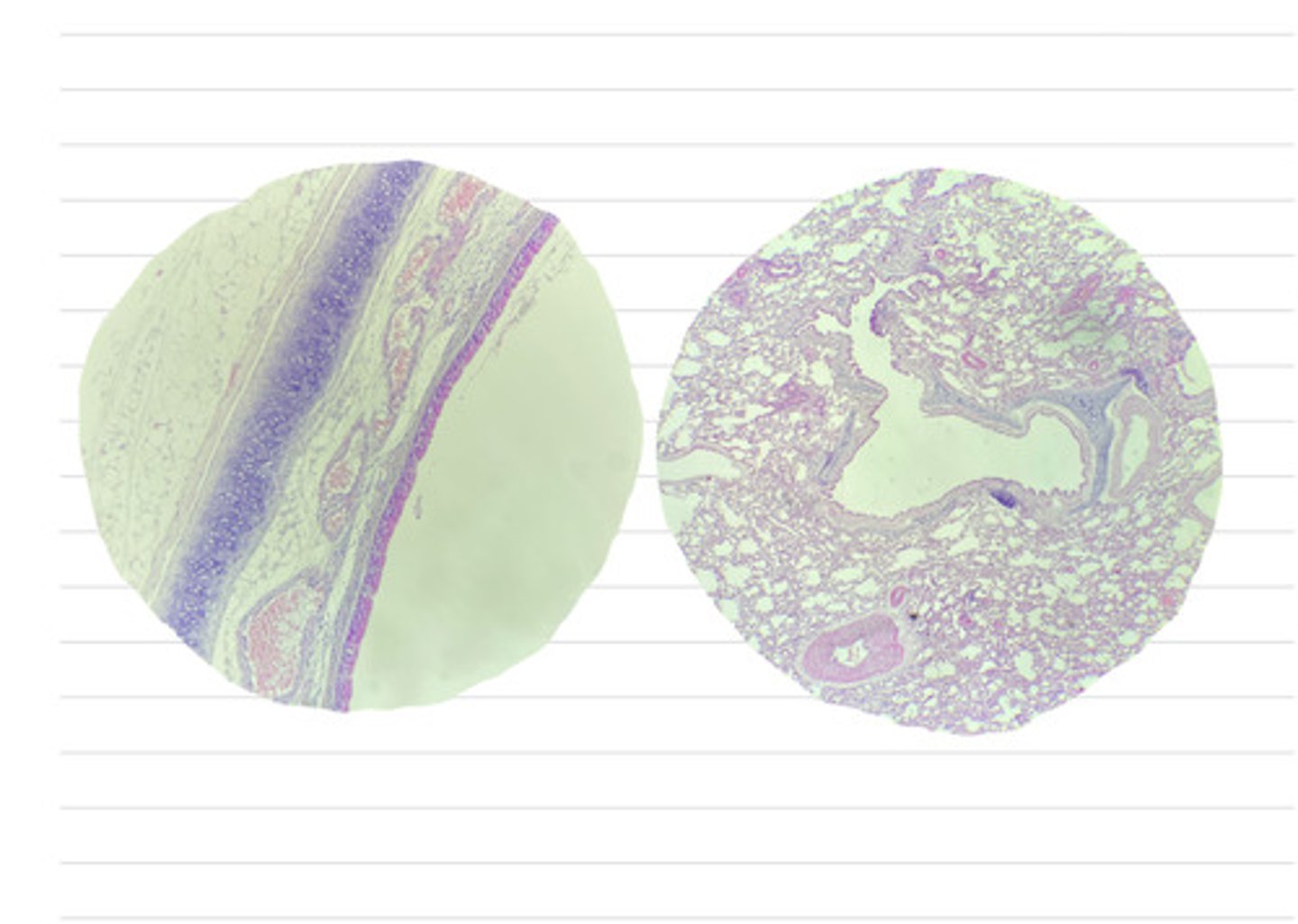 <p>what is different between a trachea and a bronchus?</p>