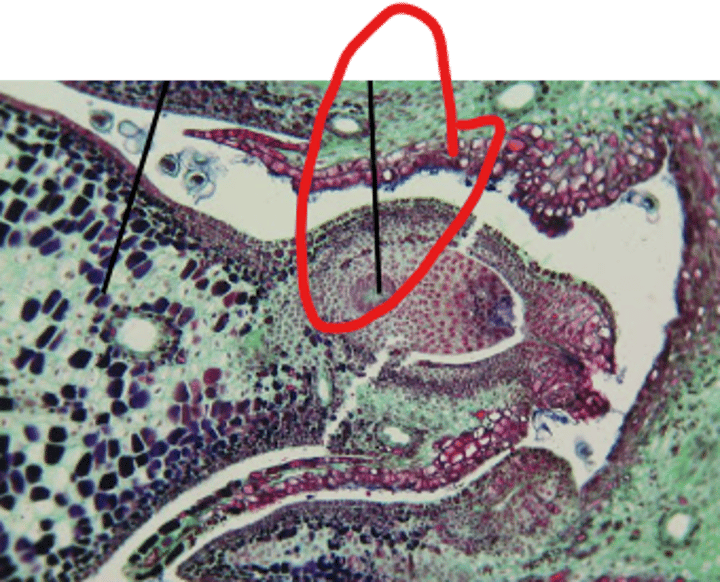 <p>ploidy of area referenced by arrow?</p>