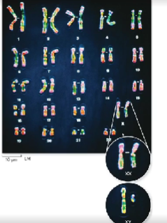 <p>the image to the right is called a __ it shows all of the chromosomes from a diploid human cell</p>