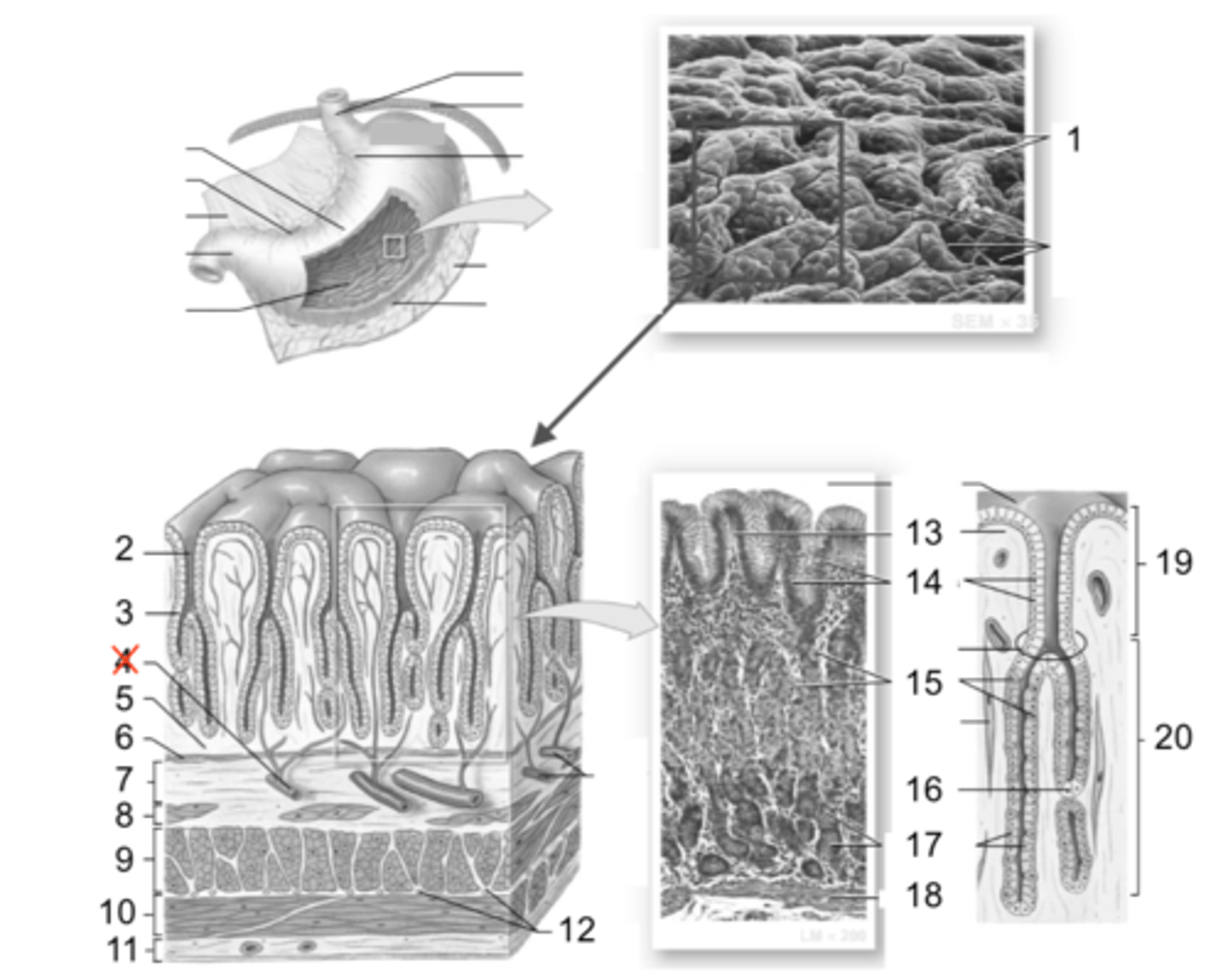 <p>- the epithelium is simple columnar and contains an increasing amount of goblet cells as you move towards the anus</p><p>(in the anal canale, a change from simple columnar to stratified squamous epithelium takes place)</p><p>LOOK AT PICTURE IN NOTES</p>