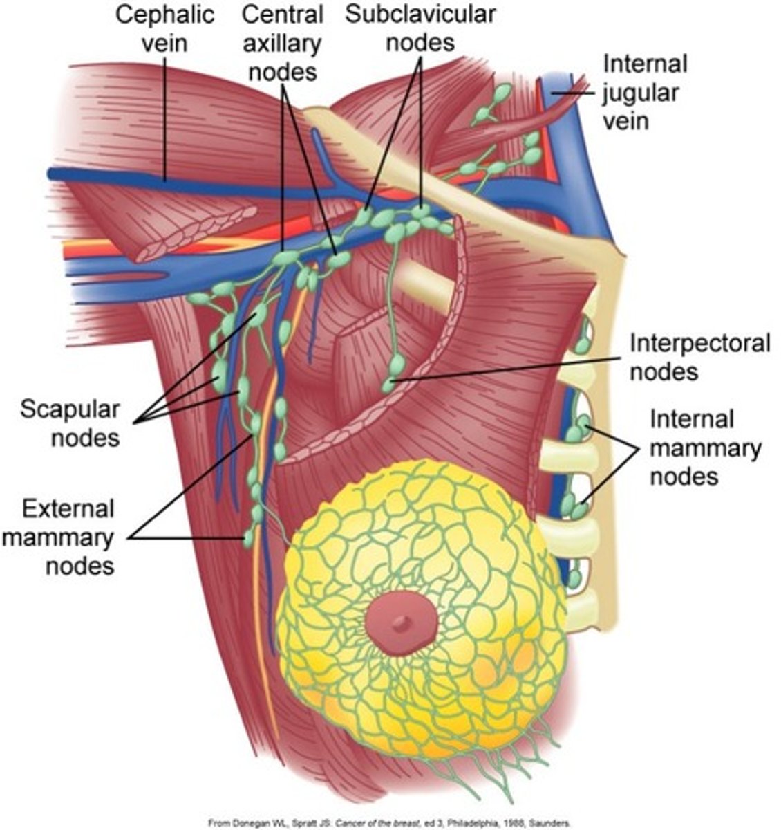 <p>wedge resection of lymph nodes based on spread</p>